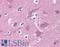 Alpha-PAK antibody, LS-B4853, Lifespan Biosciences, Immunohistochemistry paraffin image 