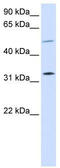 Short stature homeobox protein 2 antibody, TA344470, Origene, Western Blot image 