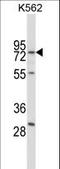 Replication protein A 70 kDa DNA-binding subunit antibody, LS-C162685, Lifespan Biosciences, Western Blot image 