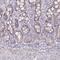 Centromere Protein H antibody, PA5-57687, Invitrogen Antibodies, Immunohistochemistry frozen image 