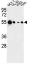 Absent In Melanoma 2 antibody, AP50126PU-N, Origene, Western Blot image 