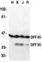 DNA Fragmentation Factor Subunit Alpha antibody, GTX74224, GeneTex, Western Blot image 