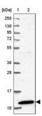 Chromosome 18 Open Reading Frame 32 antibody, PA5-59354, Invitrogen Antibodies, Western Blot image 