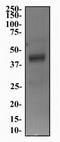 5-Hydroxytryptamine Receptor 4 antibody, NBP1-78403, Novus Biologicals, Western Blot image 
