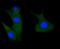 P21 (RAC1) Activated Kinase 3 antibody, NBP2-67484, Novus Biologicals, Immunocytochemistry image 