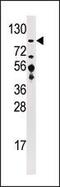 Ubiquitin Specific Peptidase 33 antibody, PA5-12058, Invitrogen Antibodies, Western Blot image 