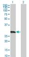 Variable charge X-linked protein 3 antibody, H00051481-M01, Novus Biologicals, Western Blot image 