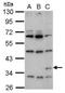 Renilla reniformis Luciferase antibody, NBP2-42916, Novus Biologicals, Western Blot image 