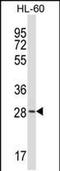 Zinc Finger DHHC-Type Containing 24 antibody, PA5-48592, Invitrogen Antibodies, Western Blot image 