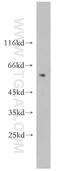 Myeloma Overexpressed antibody, 11151-1-AP, Proteintech Group, Western Blot image 