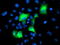 Proteasome 26S Subunit, Non-ATPase 2 antibody, TA503198, Origene, Immunofluorescence image 