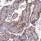 Multivesicular Body Subunit 12B antibody, NBP2-13979, Novus Biologicals, Immunohistochemistry paraffin image 