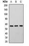 Cholinergic Receptor Nicotinic Beta 2 Subunit antibody, orb412885, Biorbyt, Western Blot image 
