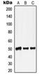 Lamin A/C antibody, LS-C352470, Lifespan Biosciences, Western Blot image 