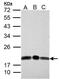 DCMP Deaminase antibody, GTX108663, GeneTex, Western Blot image 