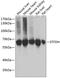 Electron Transfer Flavoprotein Dehydrogenase antibody, GTX66035, GeneTex, Western Blot image 