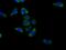 Gastrin Releasing Peptide antibody, 14646-1-AP, Proteintech Group, Immunofluorescence image 