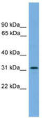Dual adapter for phosphotyrosine and 3-phosphotyrosine and 3-phosphoinositide antibody, TA334528, Origene, Western Blot image 