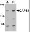 Calcium Dependent Secretion Activator antibody, orb89817, Biorbyt, Western Blot image 