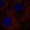 DEAD-Box Helicase 6 antibody, HPA024201, Atlas Antibodies, Immunofluorescence image 