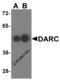 Atypical Chemokine Receptor 1 (Duffy Blood Group) antibody, 4071, ProSci, Western Blot image 