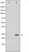 Caveolin 1 antibody, TA325302, Origene, Western Blot image 