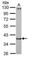 Catenin Alpha 3 antibody, GTX115881, GeneTex, Western Blot image 