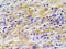 Mitogen-Activated Protein Kinase Kinase 1 antibody, AP20957PU-N, Origene, Immunohistochemistry paraffin image 