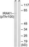 Interleukin 1 Receptor Associated Kinase 1 antibody, TA314090, Origene, Western Blot image 