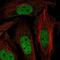 Zinc Finger Protein 131 antibody, NBP2-58632, Novus Biologicals, Immunofluorescence image 