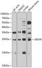 Serine/arginine-rich splicing factor 9 antibody, 19-996, ProSci, Western Blot image 