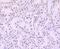 AT-Rich Interaction Domain 1A antibody, NBP2-67886, Novus Biologicals, Immunohistochemistry paraffin image 