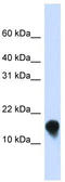 FXYD Domain Containing Ion Transport Regulator 1 antibody, TA339439, Origene, Western Blot image 