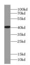 Eukaryotic Translation Elongation Factor 1 Delta antibody, FNab02648, FineTest, Western Blot image 