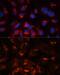 Carnitine Palmitoyltransferase 1B antibody, GTX64535, GeneTex, Immunofluorescence image 