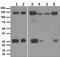Integrin Subunit Alpha V antibody, ab124968, Abcam, Western Blot image 