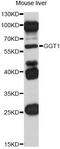 Gamma-Glutamyltransferase 1 antibody, MBS127762, MyBioSource, Western Blot image 