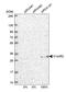 Chromosome 1 Open Reading Frame 52 antibody, HPA036072, Atlas Antibodies, Western Blot image 