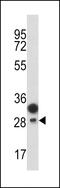 Protein C Receptor antibody, 61-578, ProSci, Western Blot image 