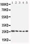 Homeobox A6 antibody, PA5-79390, Invitrogen Antibodies, Western Blot image 