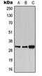 PBR antibody, orb213621, Biorbyt, Western Blot image 