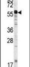 Matrix Metallopeptidase 20 antibody, PA5-13188, Invitrogen Antibodies, Western Blot image 