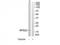Ribosomal Protein S23 antibody, TA314496, Origene, Western Blot image 