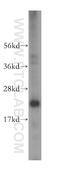 Eukaryotic Translation Initiation Factor 4E Family Member 3 antibody, 17282-1-AP, Proteintech Group, Western Blot image 