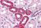 Ribosomal Protein S6 Kinase B1 antibody, MBS246971, MyBioSource, Immunohistochemistry paraffin image 