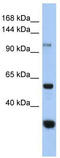 Glucosidase Alpha, Neutral C antibody, TA333376, Origene, Western Blot image 