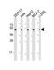 PLAG1 Like Zinc Finger 1 antibody, MBS9215944, MyBioSource, Western Blot image 