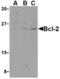 BCL2 antibody, LS-B16375, Lifespan Biosciences, Western Blot image 