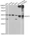 Branched Chain Amino Acid Transaminase 2 antibody, A7426, ABclonal Technology, Western Blot image 