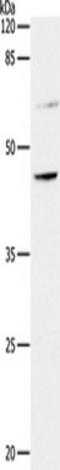 C-C Motif Chemokine Receptor 7 antibody, TA323109, Origene, Western Blot image 